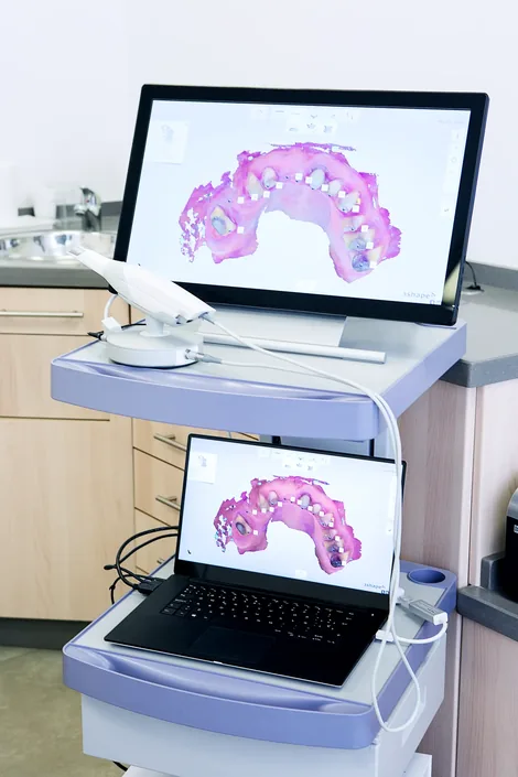 Same-day CEREC crowns Hillsboro - advanced 3D dental technology