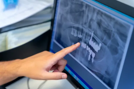 Dr. Merat Ostovar, DDS - Hillsboro Dentist and dental team at East Wind Dental Care