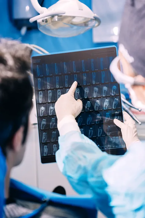Root canal therapy Hillsboro - gentle pain-free treatment