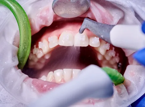 Gum disease treatment Hillsboro - periodontal care